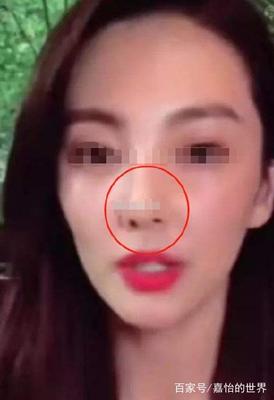 鼻翼一大一小面相