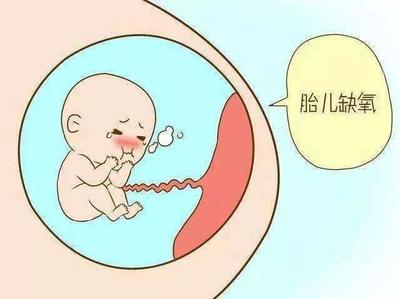 如何知道胎儿是否缺氧