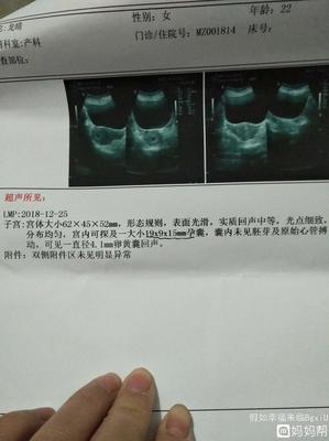 得了甲亢怎么治疗