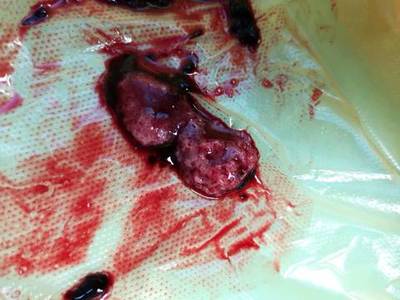 一般做个药流多少钱