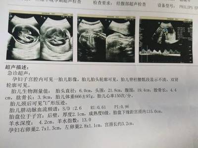 怀孕6个月做什么检查