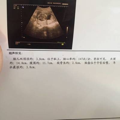 五个多月的胎儿有多大