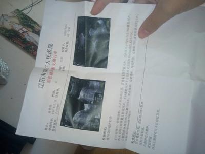 刚怀孕小腹会痛吗