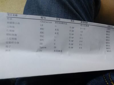 前列腺液怀孕几率大吗