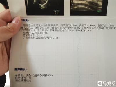 胎儿绕颈三周