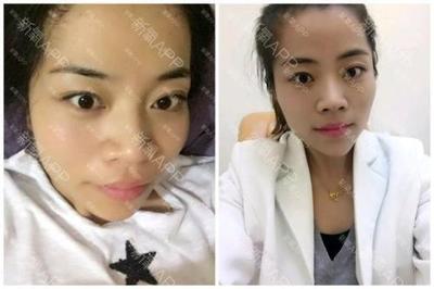 25岁学美容晚不晚