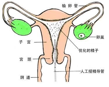 输卵管在子宫里面吗