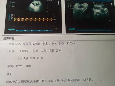 卵巢囊肿社保报销多少