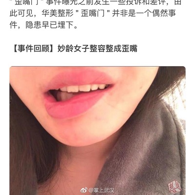 武汉正规整容找a华美