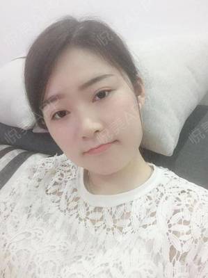 能贴双眼皮贴睡觉吗