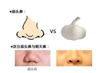 圆头鼻子的女人的面相
