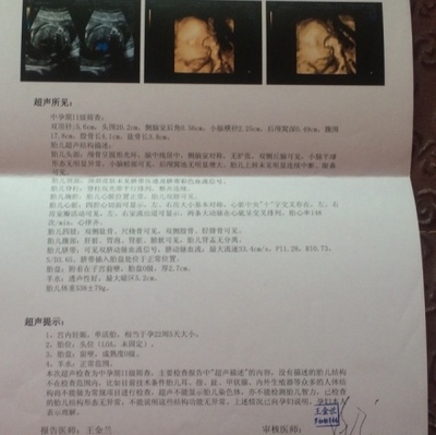 30周胎儿图片