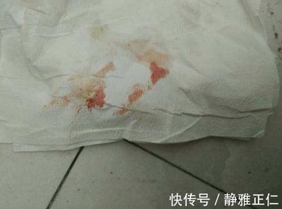 咳血便血是怎么回事