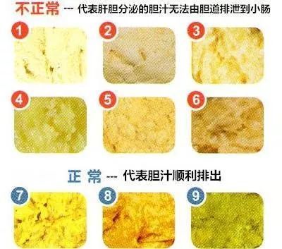 宝宝便便颜色