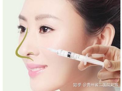 维持十年玻尿酸