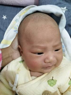 宝宝左侧头骨凸起图片