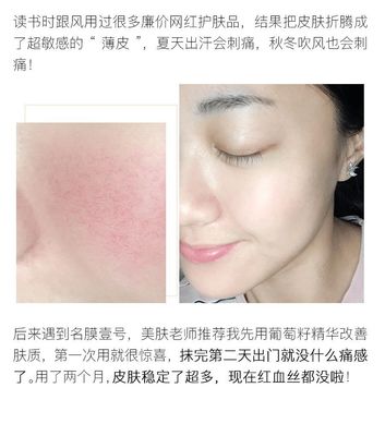 痘痘肌肤能不能用蜂蜜