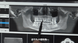 两侧牙齿不一般高