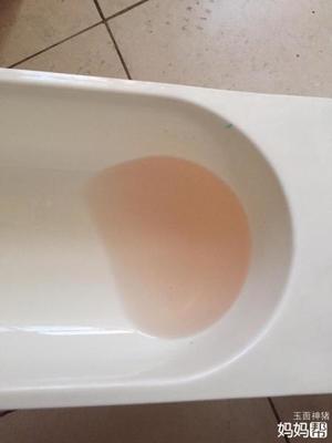 小便是红的是怎么回事