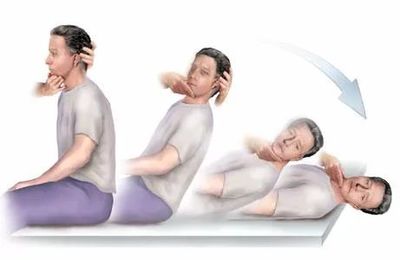 前庭功能眩晕怎么治疗