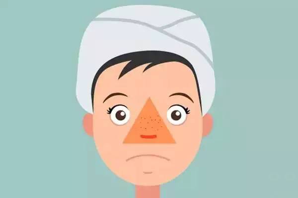 鼻头两侧痘痘怎么办