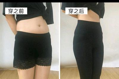 瘦腿哪里整容