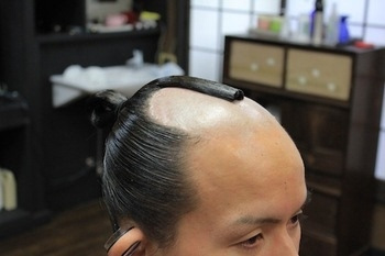 头顶没头发怎么做发型
