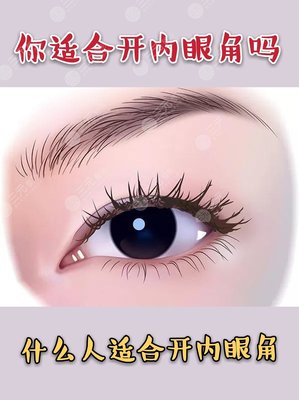小眼睛适合做双眼皮吗