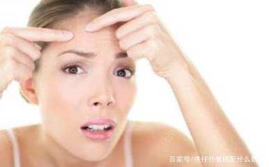 粉刺能用手挤吗