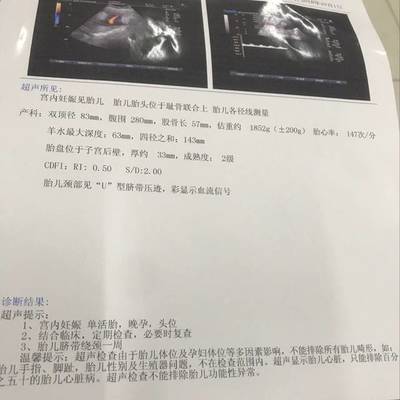 胎儿后期一周长多少斤