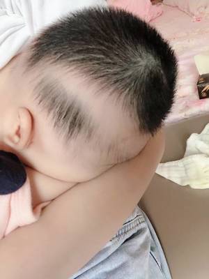 宝宝前面头发不长原因