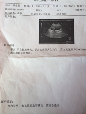 刚怀孕一个月怎么打掉