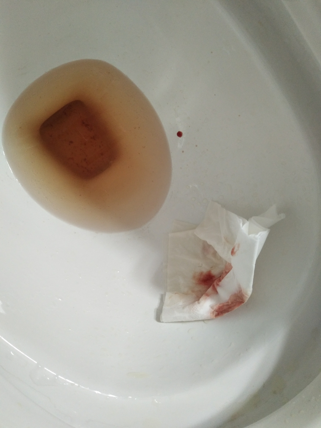 刚怀孕有血怎么回事