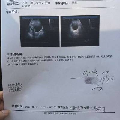 输卵管不通是怎么回事