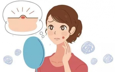 痘痘怎么清