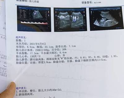 怀孕36周脐带绕颈两周怎么办