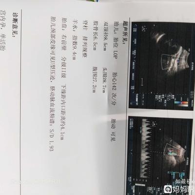 胎儿35周发育标准数值
