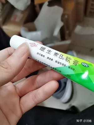 鼻子上痘痘用什么药膏