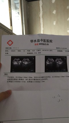 怀孕50天有胎心吗