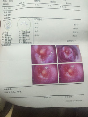 宫颈囊肿是怎么回事