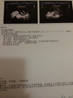 四个月胎动