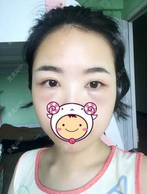 牙花子长牙是怎么回事