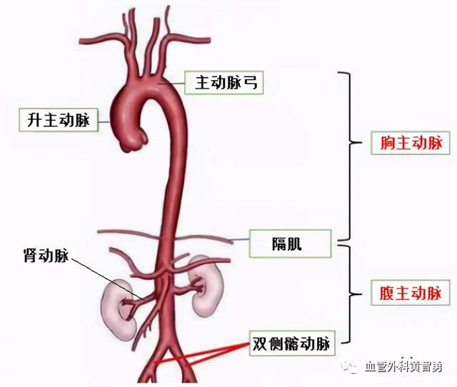 动脉扩张怎么治疗