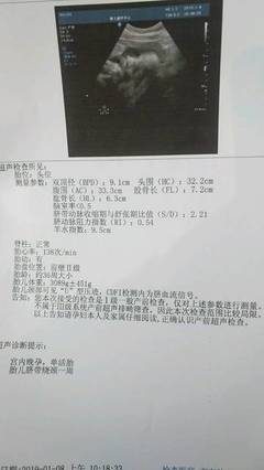 怀孕几个月能看出来男女