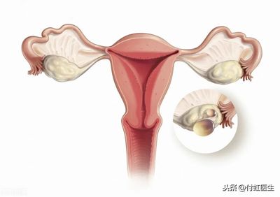 不是排卵期出血