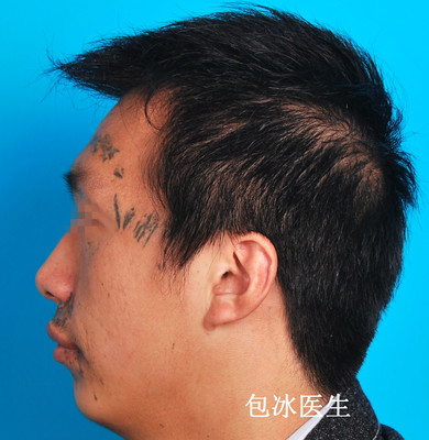 口唇白是怎么回事