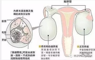 一侧睾丸疼痛是怎么回事