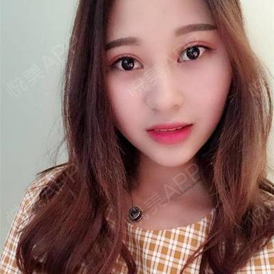 天气热割双眼皮
