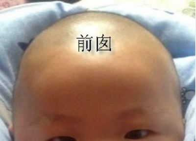 宝宝左侧头骨凸起图片