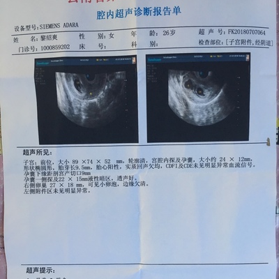 怀孕位置低